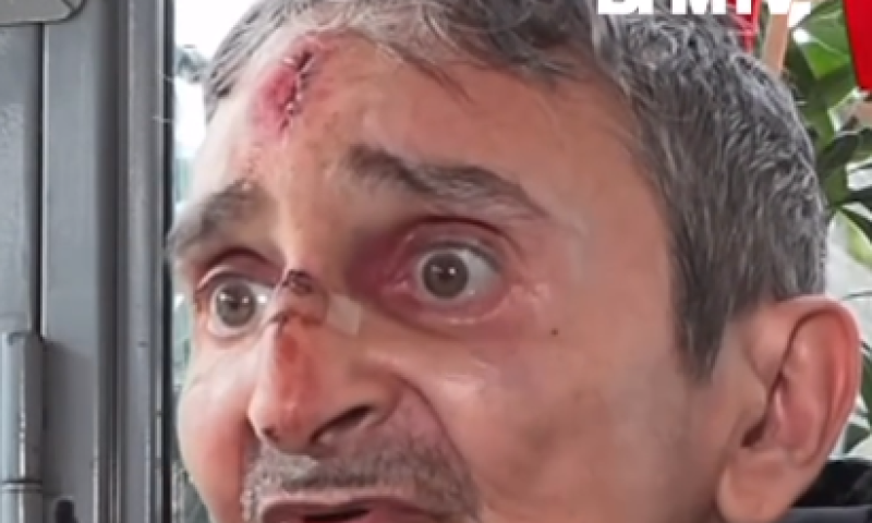 היהודי שנדקר בפריז: "בזיון והשפלה, לא יכולתי להתגונן"