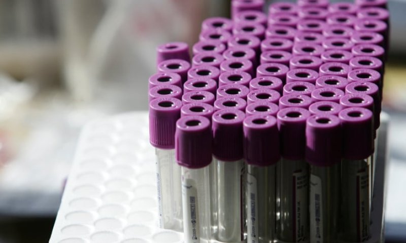 אז מה זה בעצם המאגר הלאומי למח עצם?