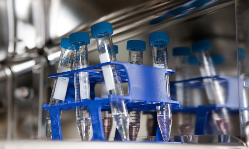 עוברת טיפולי פוריות? כך תשמרי על זוגיות שפויה