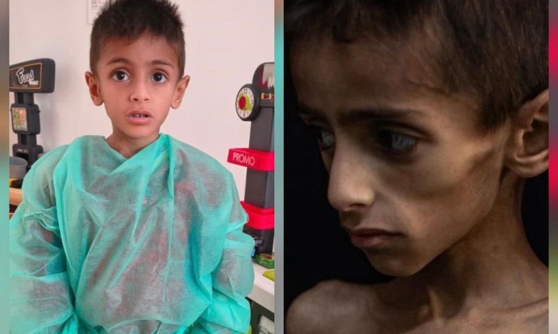 רעב בעזה? המתפ"ש מבהיר: "התמונה הוויראלית היא פייק"