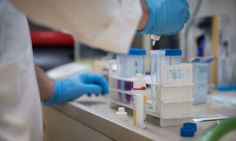 המכון הביולוגי מנמיך ציפיות: טרם מצאנו תרופה