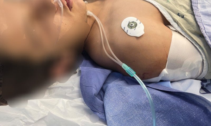 הפרט שדובר צה"ל הסתיר: נער בן 14 נפצע מהירי של החיילים