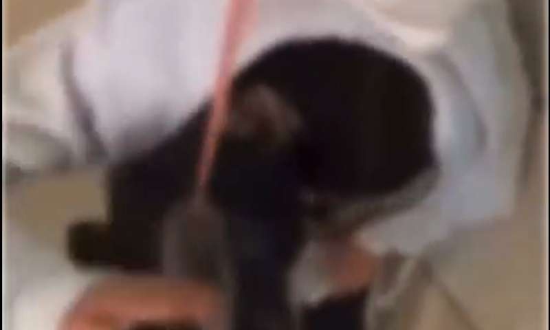 הנערה ששפכו עליה אקונומיקה: "הם צחקו"