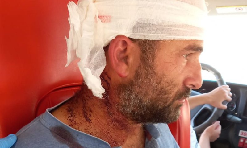 לינץ' בהר חברון: פלסטינים היכו נהג יהודי במוטות ואבנים