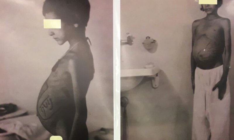 מזעזע: בתי החולים ביצעו ניסויים בילדי תימן החטופים