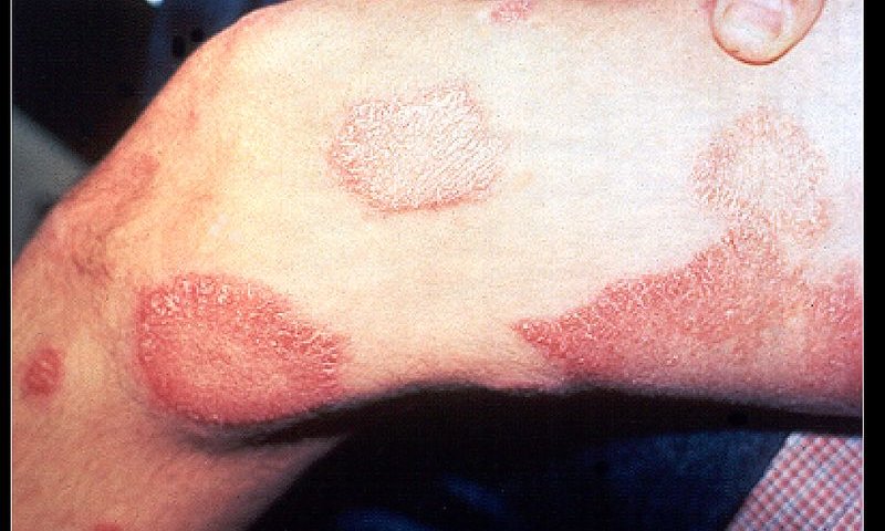 פרשת תזריע-מצורע: פעמוני האזעקה הרוחניים מצלצלים