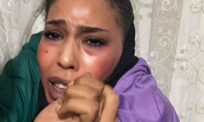 כך נלכדה המחבלת שביצעה את הפיגוע בטורקיה