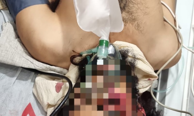 חוות מעון: ישראלי הותקף בראשו במעדר &ndash; מצבו קשה