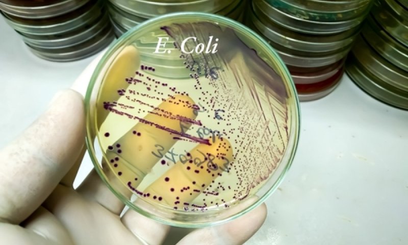 זיהום מסכן חיים מתפשט בישראל. אלו התסמינים