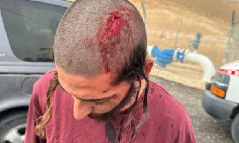 מצפה יריחו: פועלי פינוי אשפה תקפו ופצעו נער