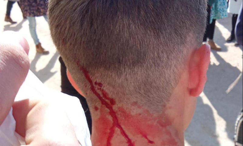 כרם שלום: חיילים פינו בכוח חוסמי משאיות