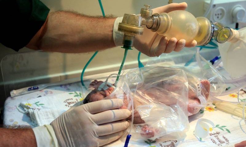 קורונה: בבית החולים הדסה נפטר תינוק בן חודשיים