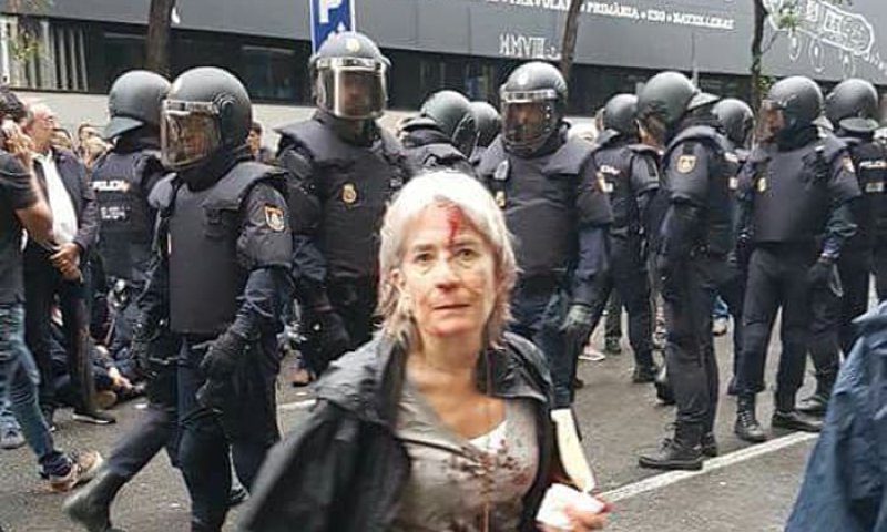 תוצאות קשות במהומות בקטלוניה: 465 פצועים