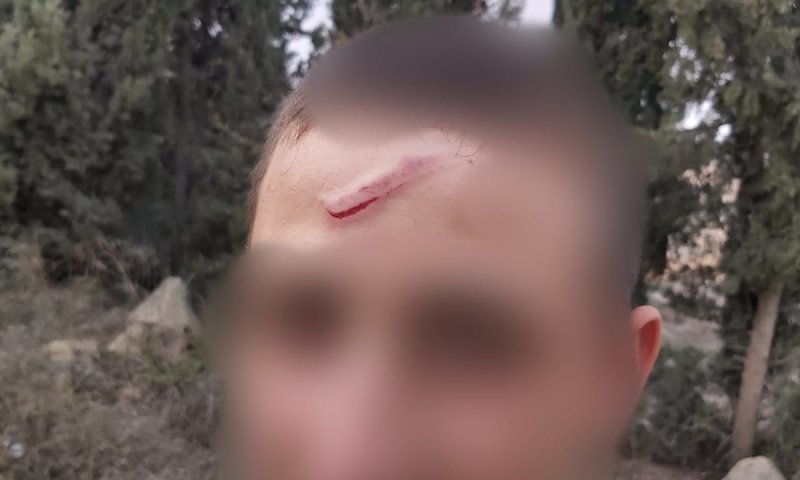 במחאה על הפיגוע: שוטר מג"ב פצע נער בן 14