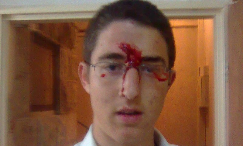 אתמול במזרח ירושלים, כמעט לינץ' במשפחה ישראלית