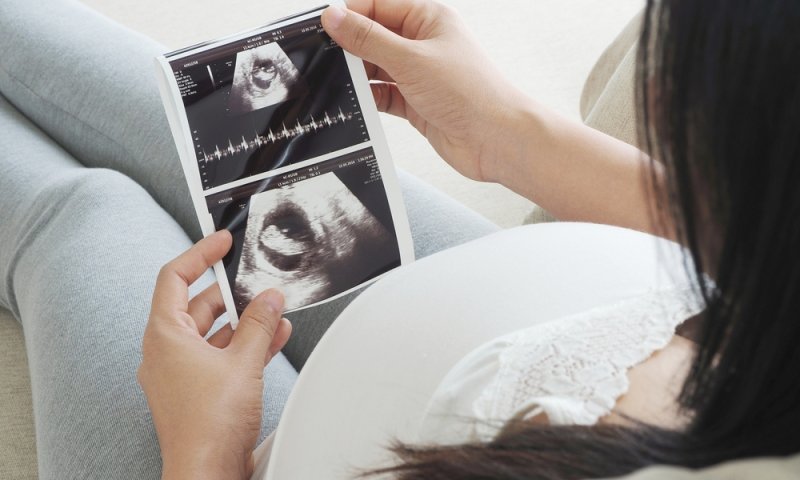 האם הגיע הזמן לקרוא לנשואים להקפיא עוברים?