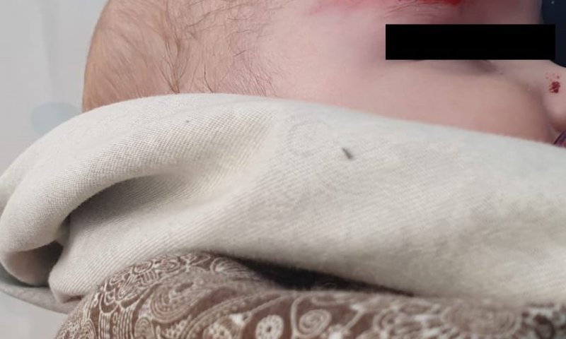 נתפסו הערבים שניסו לרצוח תינוקת בת 7 חודשים