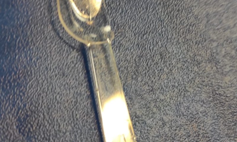 מפחיד: חלק מכפית פלסטיק חולץ מגרונו של פעוט