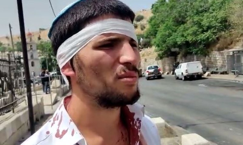 הנהג המותקף: חטפנו אבנים, בעיטות וגז פלפל לאוטו