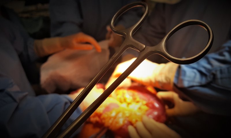 עמותה המסייעת להשתלות אברים חשודה בקבלת שוחד