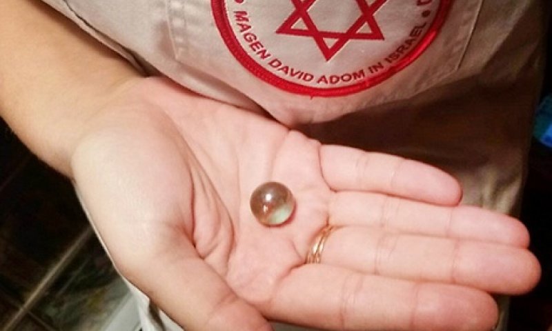 אסון בבני ברק: נפטר הפעוט שבלע גולה ונחנק