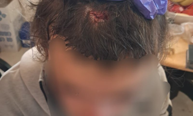 בחסות פעילי שמאל: 2 נערים יהודים הותקפו ע"י פלסטינים בסוסיא