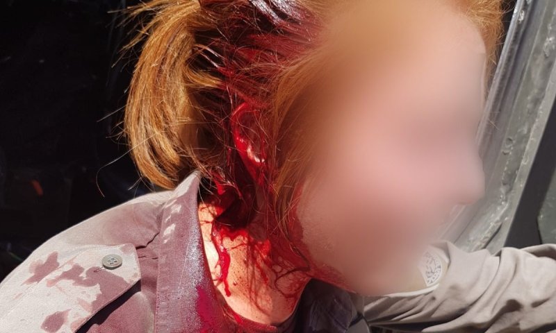 בושה: נערי גבעות פצעו חיילת מג"ב בראשה. צפו