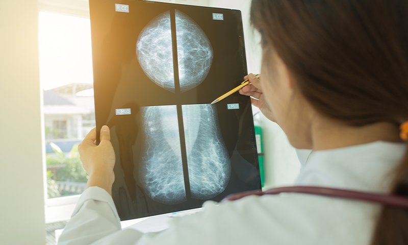 הרבנים החרדים שוברים טאבו ביחס לסרטן השד