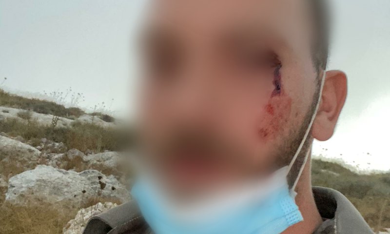 המשטרה: יהודים תקפו לוחמי מג"ב בסמוך ליצהר