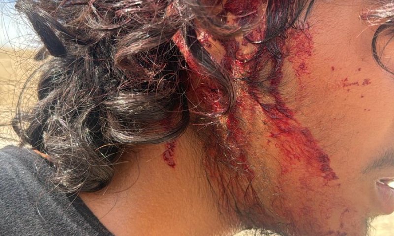 דיווח: ערבים תקפו רועי צאן יהודים ליד מבואות יריחו