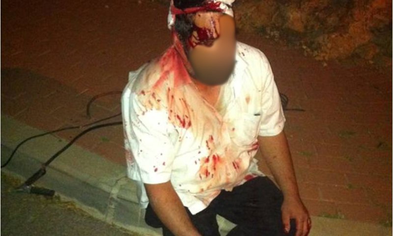 מצבו של היהודי שנפגע בראשו מאבן ממשיך להיות קשה