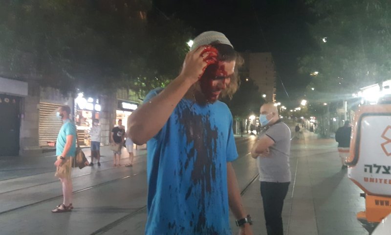 ארגון להב"ה: להט"בים תקפו פעיל בארגון