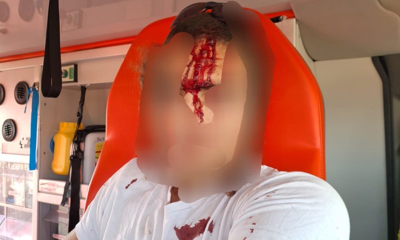 סכנה לחייו: החמרה במצב הפצוע מהלינץ' בבנימין