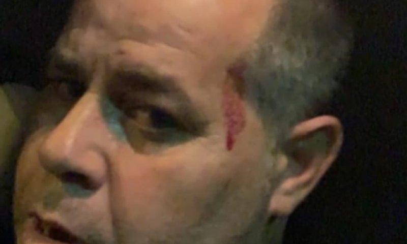 החשוד בתקיפת כתב ישראל היום הורשע בהריגת אדם אחר