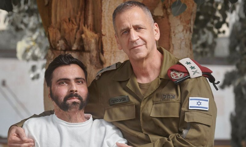 מרגש: תערוכה מיוחדת להעלאת המודעות להלומי קרב