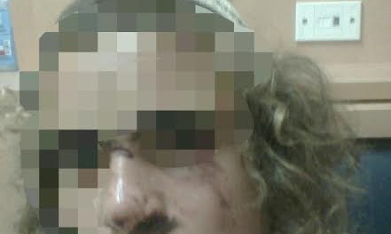 קטין שנפצע בפשיטה על הישיבה פונה לביה"ח