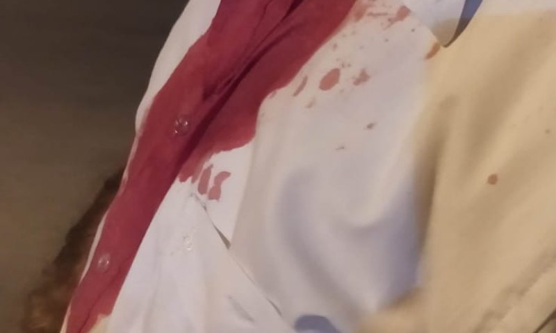 עשרות רעולי פנים רגמו באבנים משפחה בשומרון