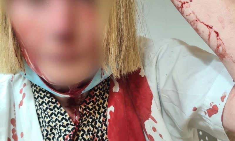 באר יעקב: הוארך מעצר החשוד בתקיפת הרופאה