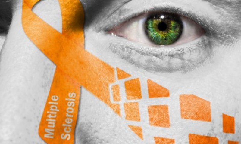 איך תדעו אם אתם חולים בטרשת נפוצה