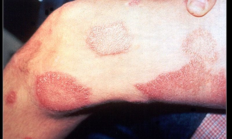 פרשת תזריע: פעמוני האזעקה הרוחניים מצלצלים