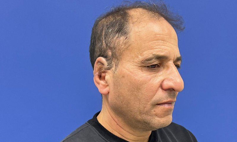 שערי צדק: הדפיסו אוזן והשתילו בטכנולוגיה חדישה