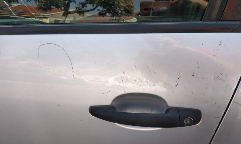 הדסה ניצלה מפיגוע אבנים: "איך ממשיכים לחיות כך?"