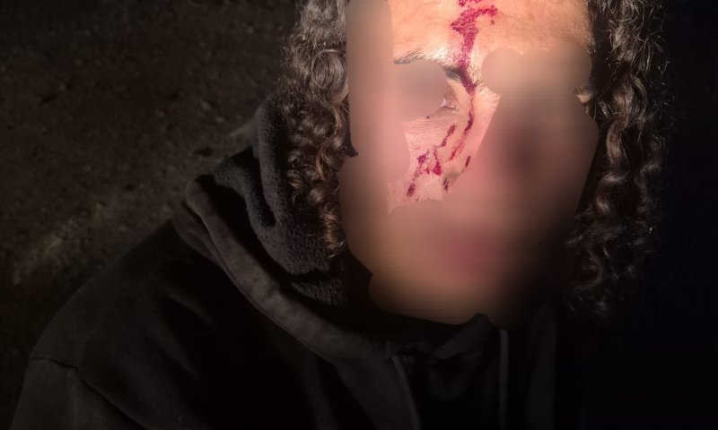 אירוע אלימות סמוך לענתות: פורעים ערבים תקפו רועי צאן