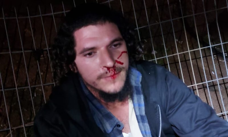 שוב אלימות ביצהר: ג'יפ נגח ברכב, שוטרים תקפו תושב