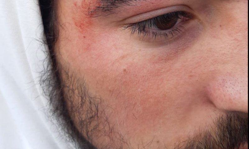 עימותים ביצהר: פלסטינים יידו אבנים, תושב נפצע קל