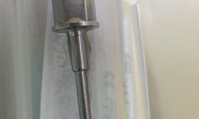 מומחי הריאות שלפו מברג מריאותיו של בן 62