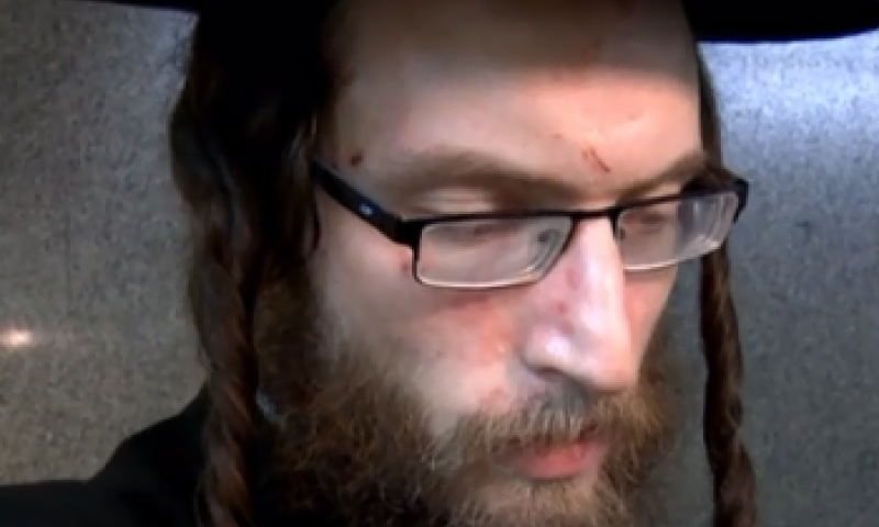 החרדי שמשכו בפאותיו: "אמרו לי אתה תמות היום"