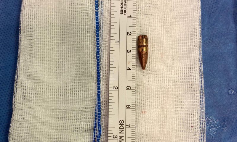 הרופאים הצילו בן 9 מראס אל עמוד שנורה בראשו