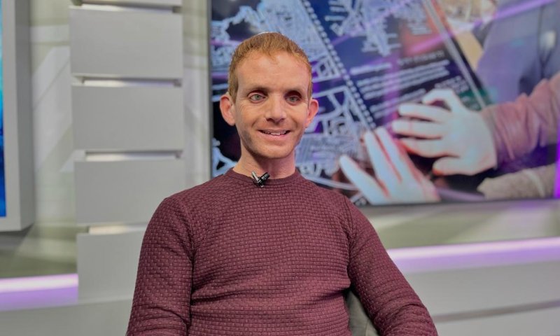 אביחי שלי לסרוגים: "הילדים שלי מקבלים את המוגבלות"