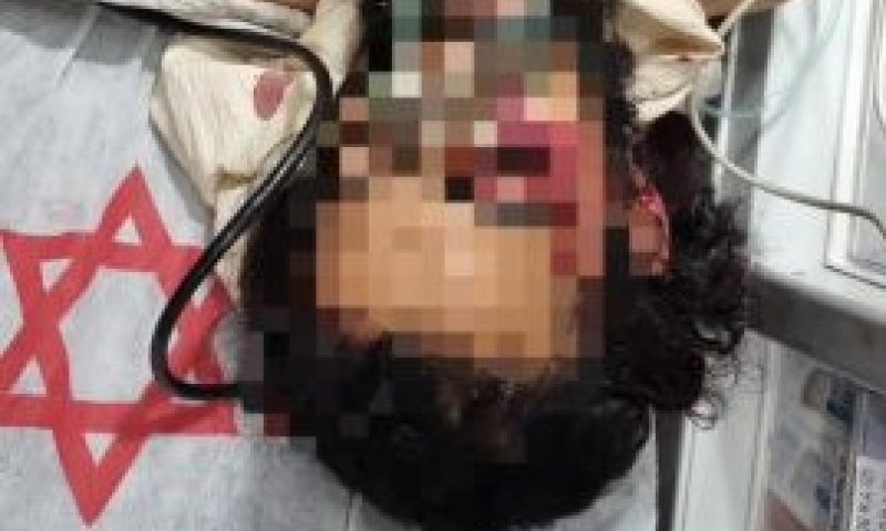 פצוע הלינץ' מהר חברון שב להכרה; מצבו קשה